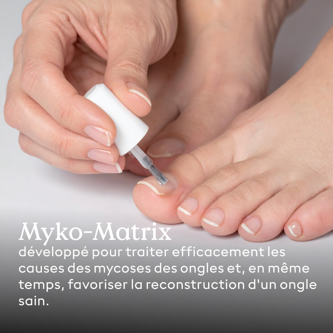 Solution contre les mycoses des ongles Myko-Matrix